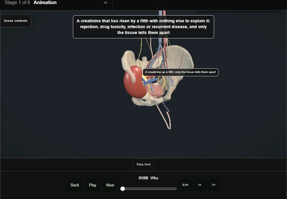 Renal allograft biopsy. Step 1: Who. Captured frame from the interactive animation.