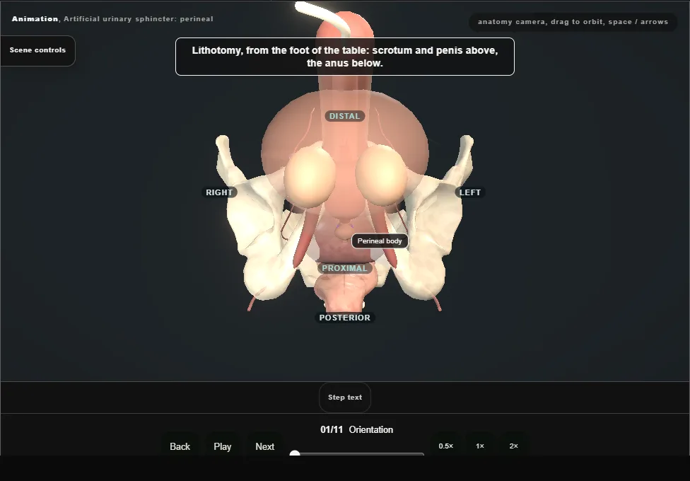 Artificial urinary sphincter: perineal. Step 1: Orientation. Captured frame from the interactive animation.