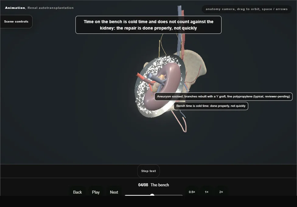 Renal autotransplantation. Step 4: The bench. Captured frame from the interactive animation.