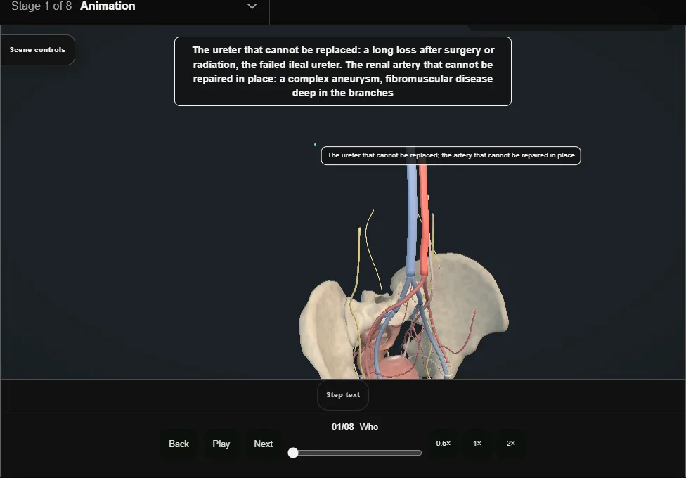 Renal autotransplantation. Step 1: Who. Captured frame from the interactive animation.