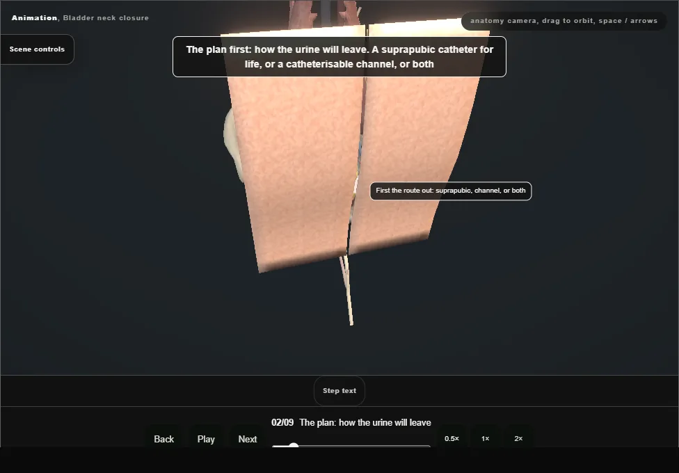 Bladder neck closure. Step 2: The plan: how the urine will leave. Captured frame from the interactive animation.