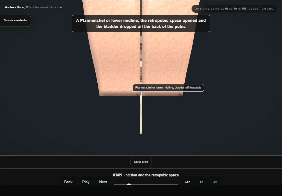 Bladder neck closure. Step 3: Incision and the retropubic space. Captured frame from the interactive animation.
