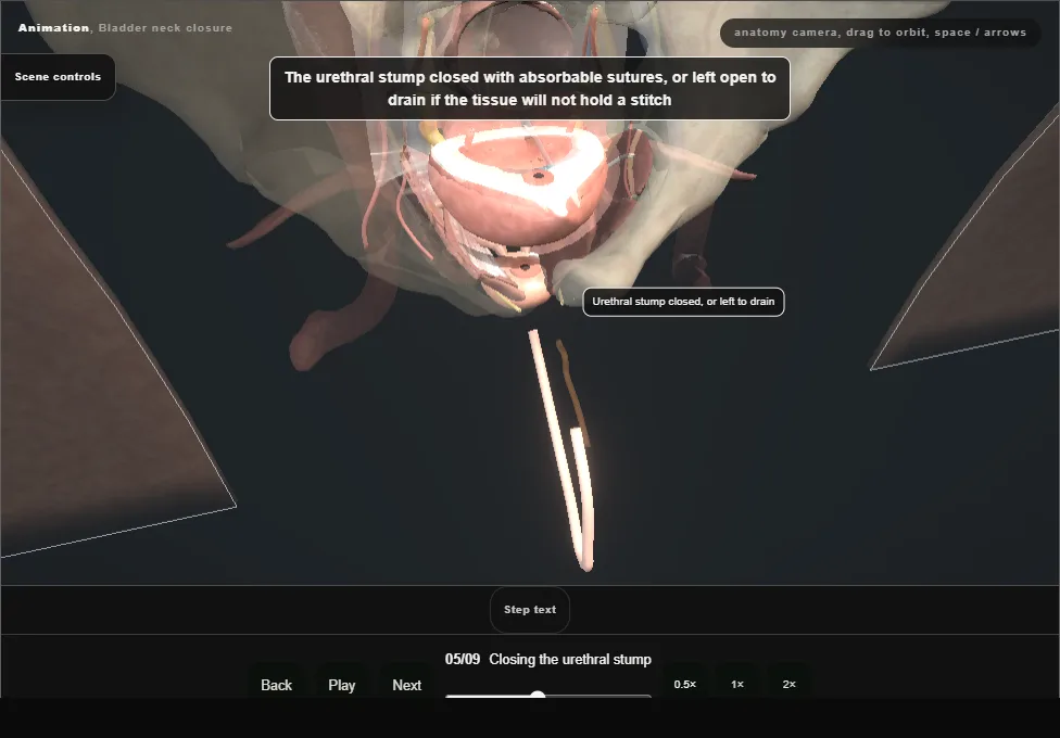 Bladder neck closure. Step 5: Closing the urethral stump. Captured frame from the interactive animation.