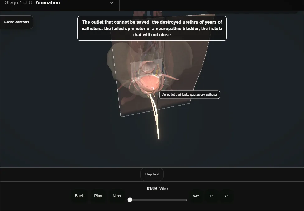 Bladder neck closure. Step 1: Who. Captured frame from the interactive animation.