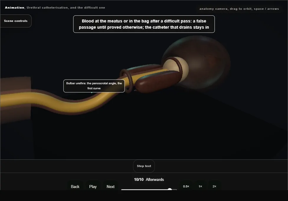 Urethral catheterisation, and the difficult one. Step 10: Afterwards. Captured frame from the interactive animation.