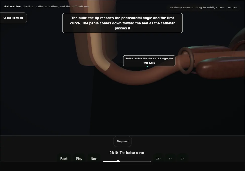 Urethral catheterisation, and the difficult one. Step 4: The bulbar curve. Captured frame from the interactive animation.