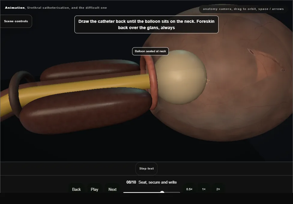 Urethral catheterisation, and the difficult one. Step 8: Seat, secure and write. Captured frame from the interactive animation.