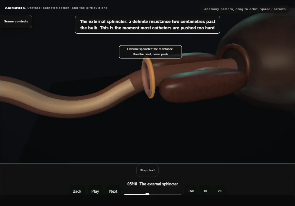 Urethral catheterisation, and the difficult one. Step 5: The external sphincter. Captured frame from the interactive animation.