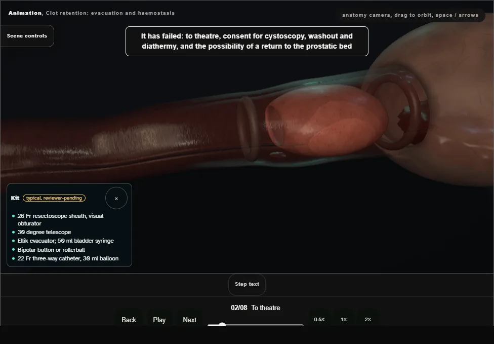 Clot retention: evacuation and haemostasis. Step 2: To theatre. Captured frame from the interactive animation.