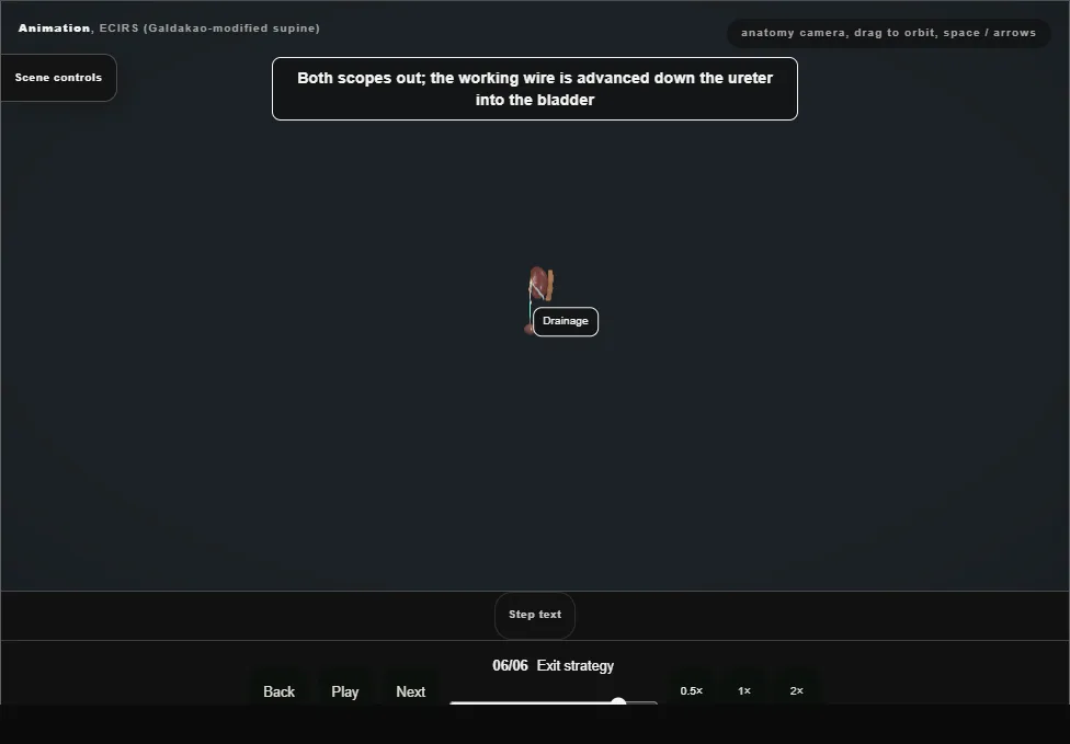 ECIRS (Galdakao-modified supine). Step 6: Exit strategy. Captured frame from the interactive animation.
