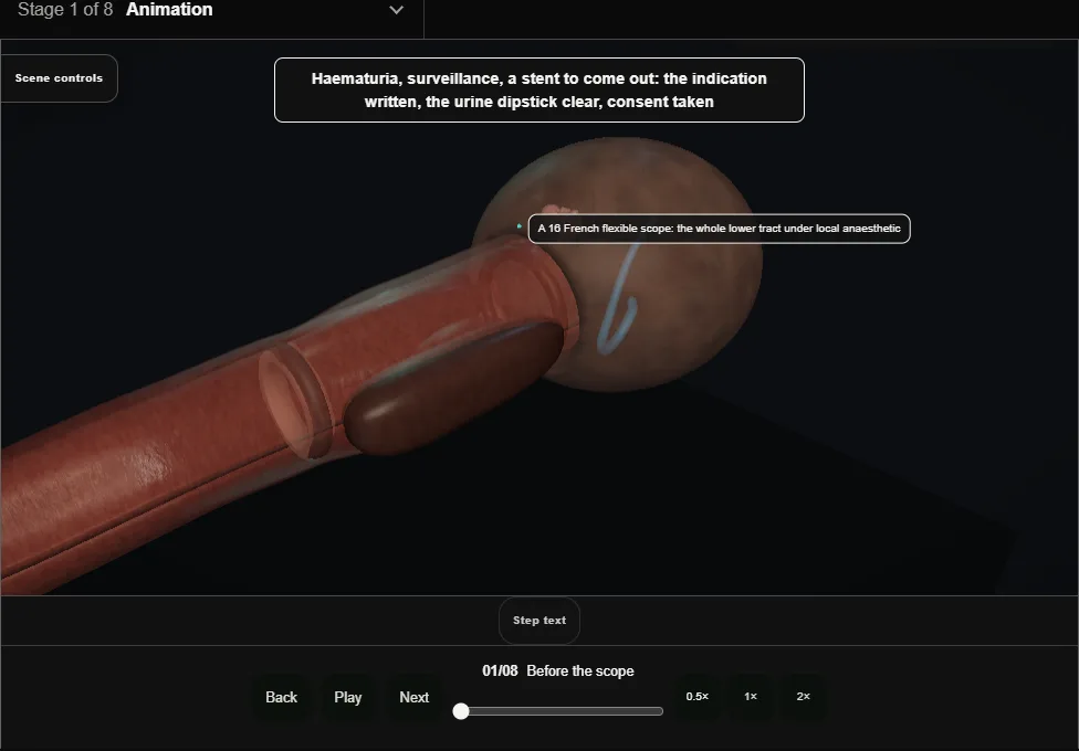 Flexible cystoscopy: the outpatient look. Step 1: Before the scope. Captured frame from the interactive animation.