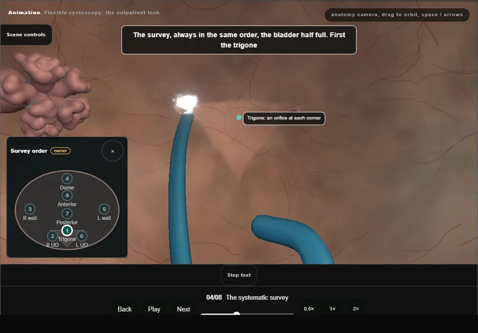 Flexible cystoscopy: the outpatient look. Step 4: The systematic survey. Captured frame from the interactive animation.