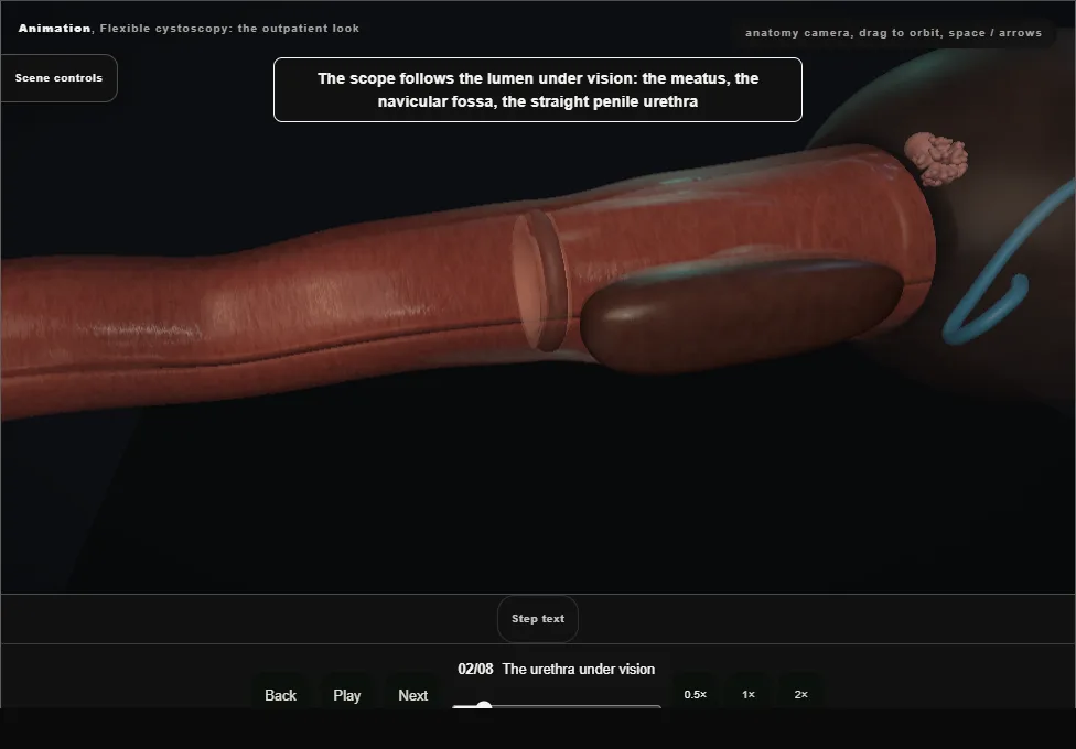 Flexible cystoscopy: the outpatient look. Step 2: The urethra under vision. Captured frame from the interactive animation.