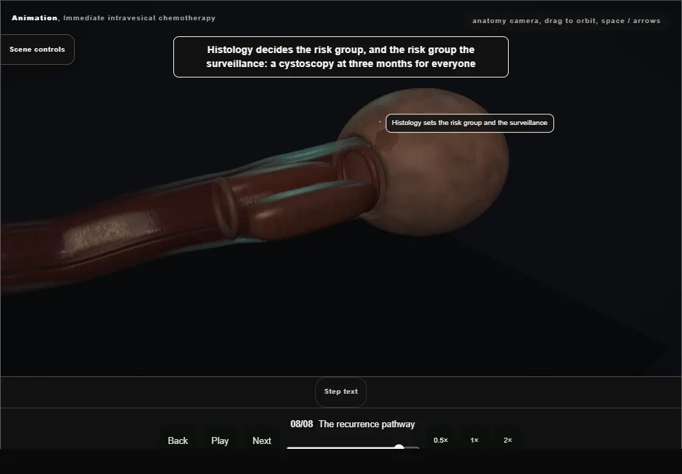 Immediate intravesical chemotherapy. Step 8: The recurrence pathway. Captured frame from the interactive animation.
