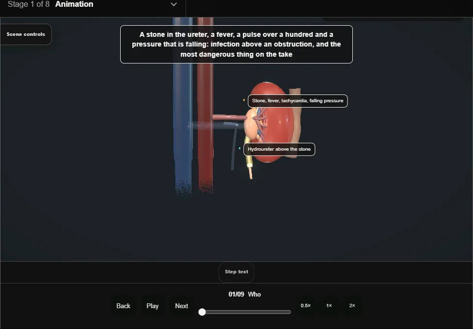 Emergency decompression of the infected obstructed kidney. Step 1: Who. Captured frame from the interactive animation.