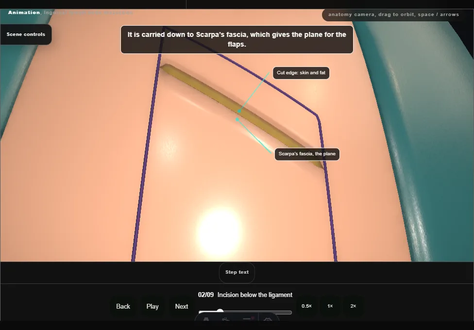 Inguinal lymph node dissection. Step 2: Incision below the ligament. Captured frame from the interactive animation.