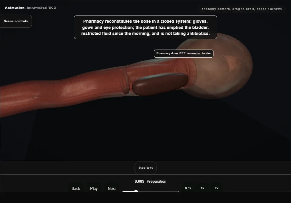 Intravesical BCG. Step 3: Preparation. Captured frame from the interactive animation.