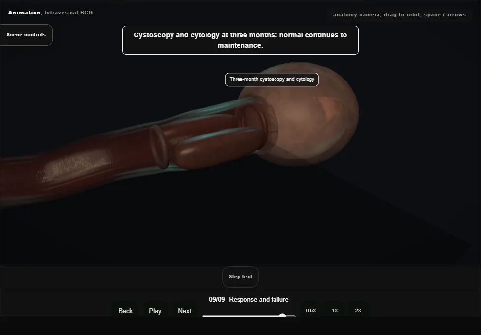 Intravesical BCG. Step 9: Response and failure. Captured frame from the interactive animation.