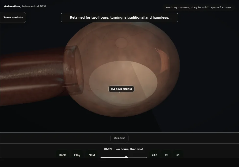 Intravesical BCG. Step 6: Two hours, then void. Captured frame from the interactive animation.