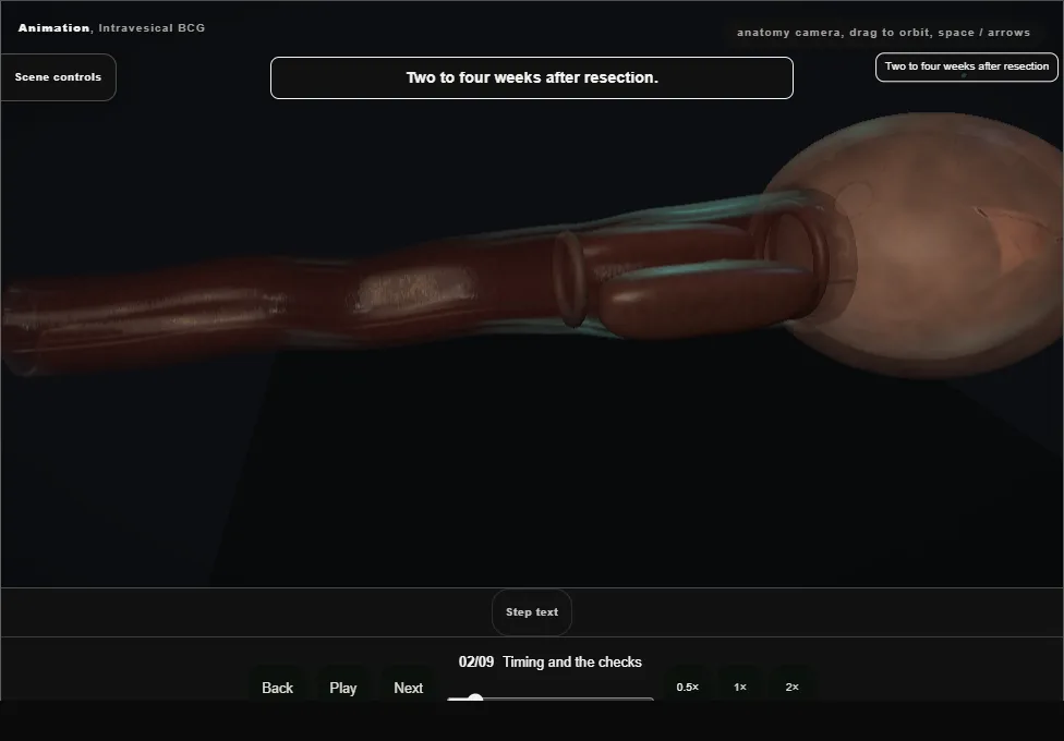 Intravesical BCG. Step 2: Timing and the checks. Captured frame from the interactive animation.
