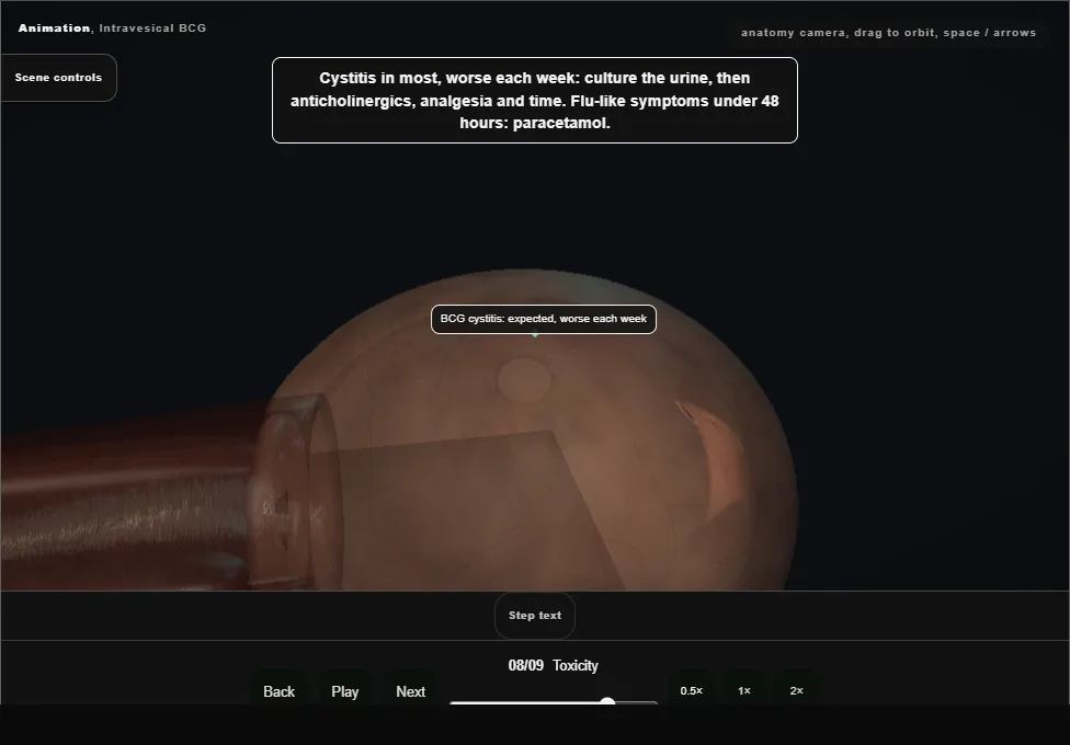 Intravesical BCG. Step 8: Toxicity. Captured frame from the interactive animation.