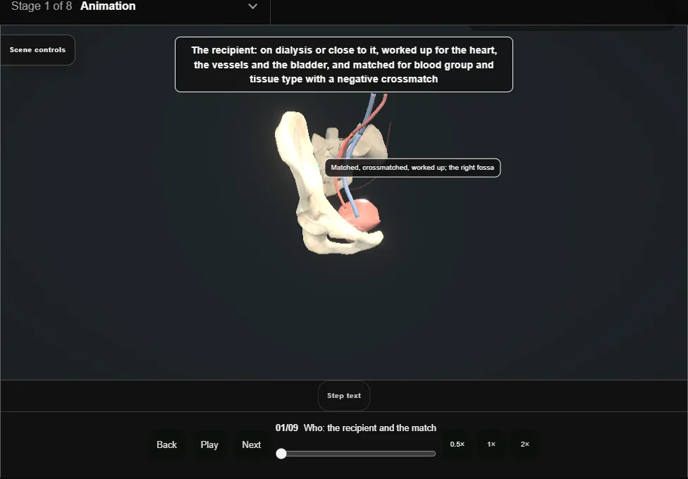 Recipient kidney transplantation. Step 1: Who: the recipient and the match. Captured frame from the interactive animation.