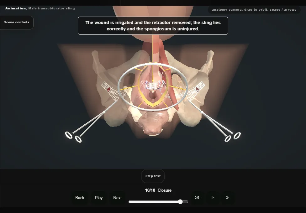 Male transobturator sling. Step 10: Closure. Captured frame from the interactive animation.