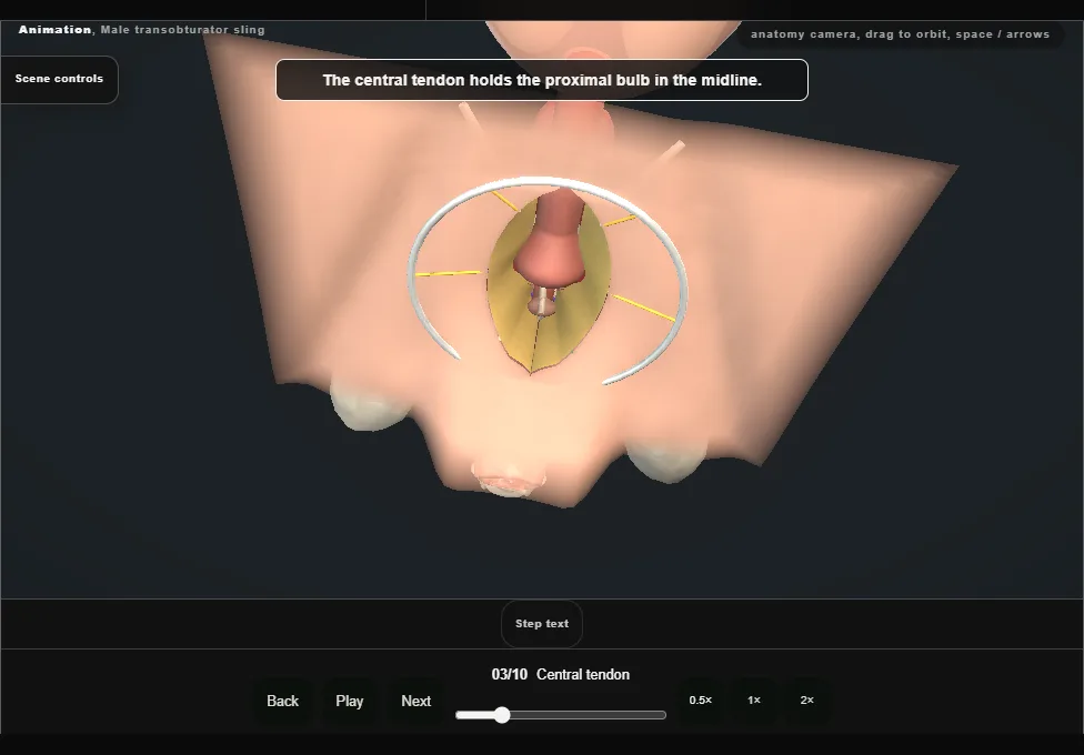 Male transobturator sling. Step 3: Central tendon. Captured frame from the interactive animation.