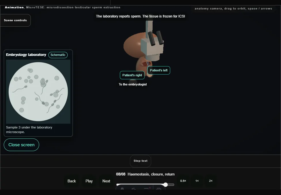 MicroTESE: microdissection testicular sperm extraction. Step 8: Haemostasis, closure, return. Captured frame from the interactive animation.