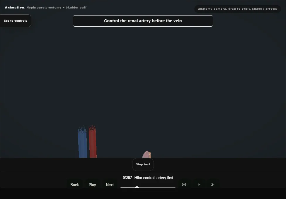 Nephroureterectomy + bladder cuff. Step 3: Hilar control, artery first. Captured frame from the interactive animation.