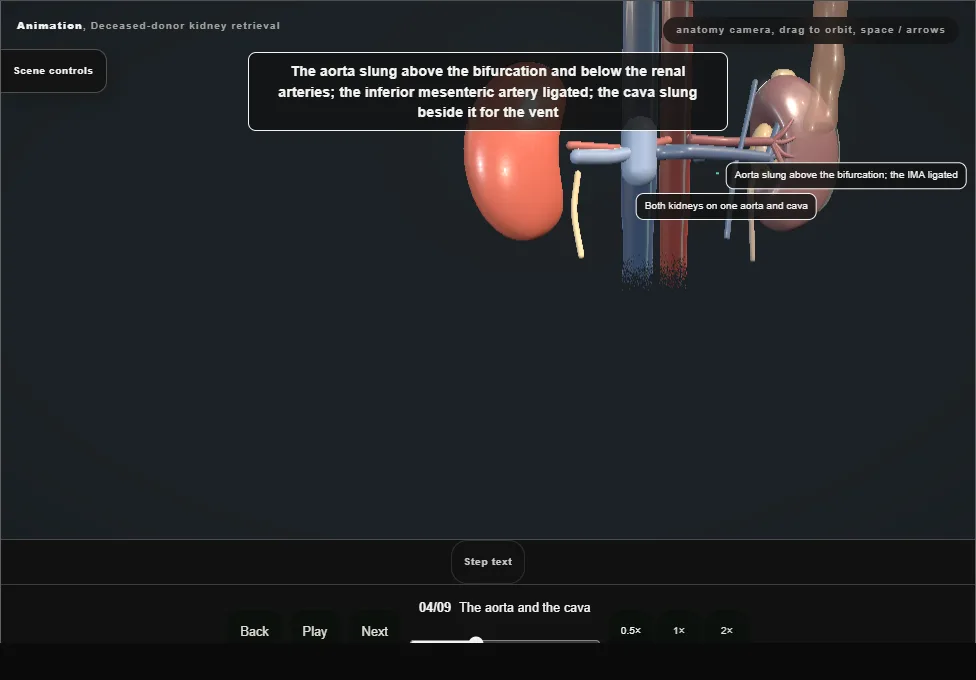 Deceased-donor kidney retrieval. Step 4: The aorta and the cava. Captured frame from the interactive animation.