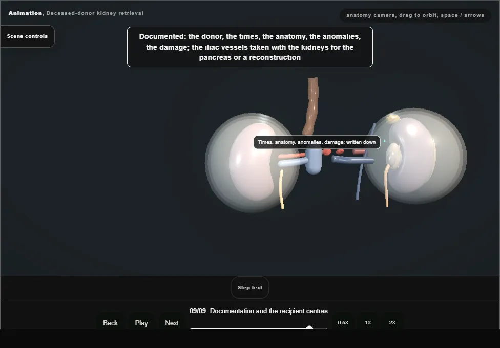 Deceased-donor kidney retrieval. Step 9: Documentation and the recipient centres. Captured frame from the interactive animation.