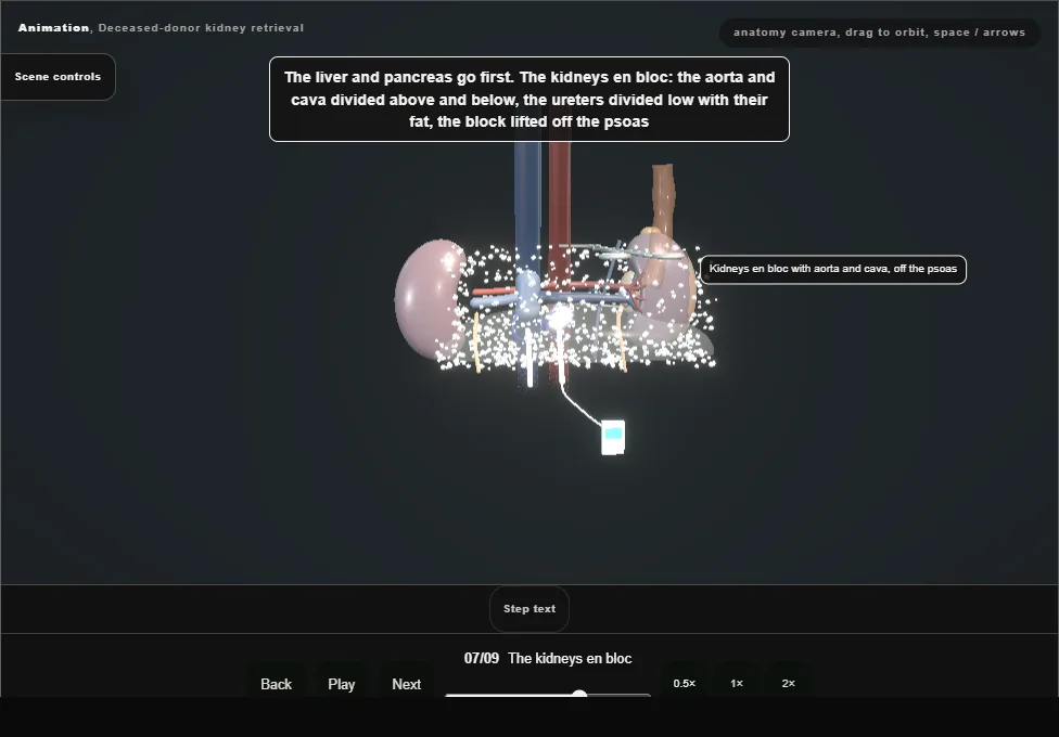 Deceased-donor kidney retrieval. Step 7: The kidneys en bloc. Captured frame from the interactive animation.