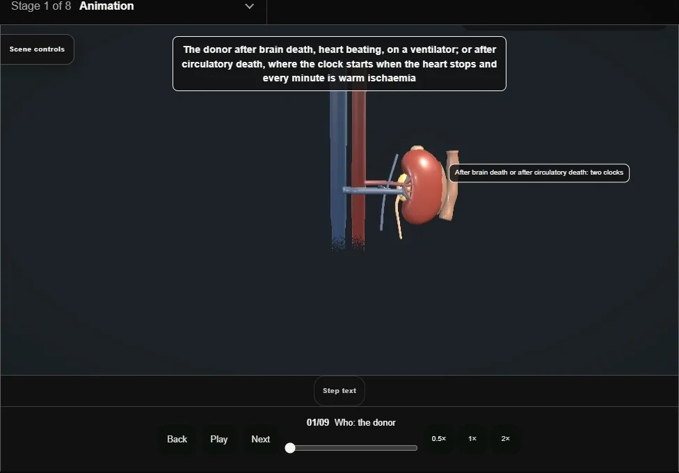 Deceased-donor kidney retrieval. Step 1: Who: the donor. Captured frame from the interactive animation.