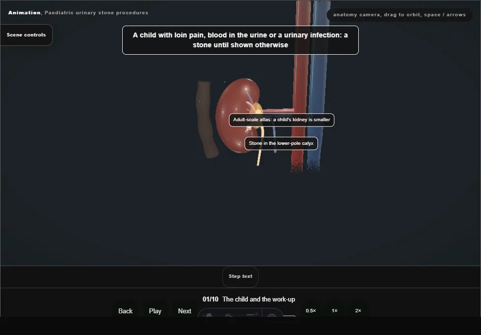Paediatric urinary stone procedures. Step 1: The child and the work-up. Captured frame from the interactive animation.