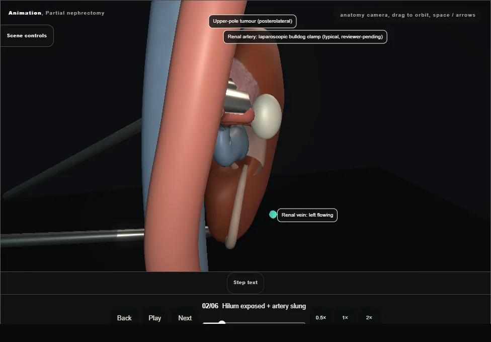 Partial nephrectomy. Step 2: Hilum exposed + artery slung. Captured frame from the interactive animation.