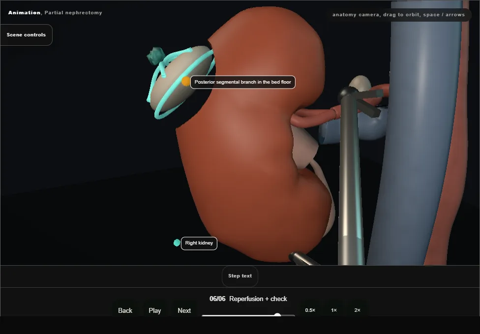 Partial nephrectomy. Step 6: Reperfusion + check. Captured frame from the interactive animation.