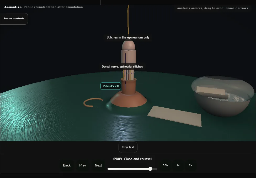 Penile reimplantation after amputation. Step 9: Close and counsel. Captured frame from the interactive animation.