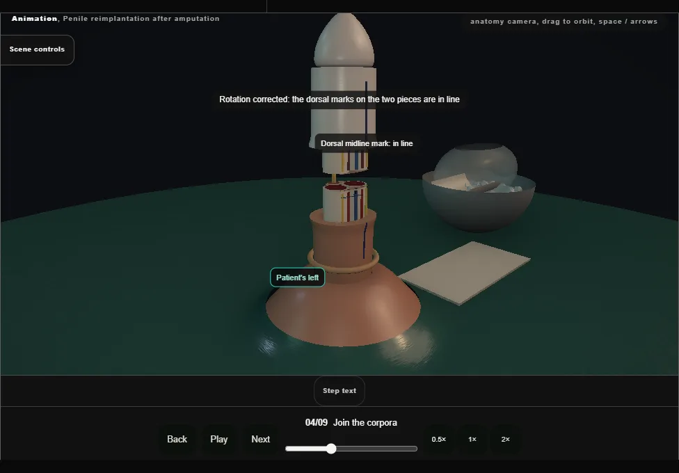 Penile reimplantation after amputation. Step 4: Join the corpora. Captured frame from the interactive animation.