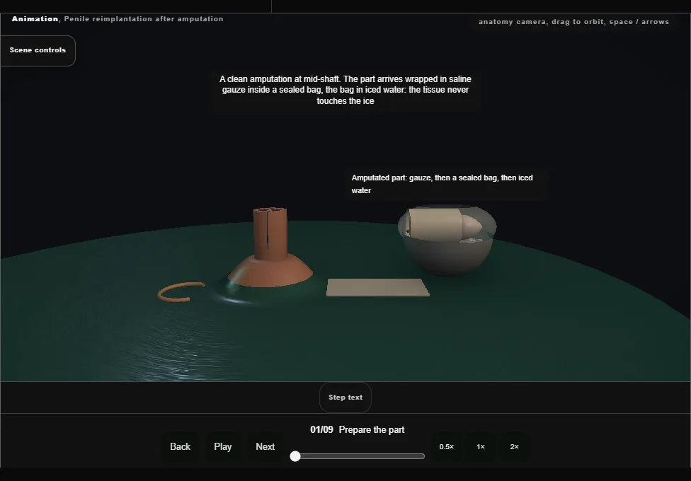 Penile reimplantation after amputation. Step 1: Prepare the part. Captured frame from the interactive animation.