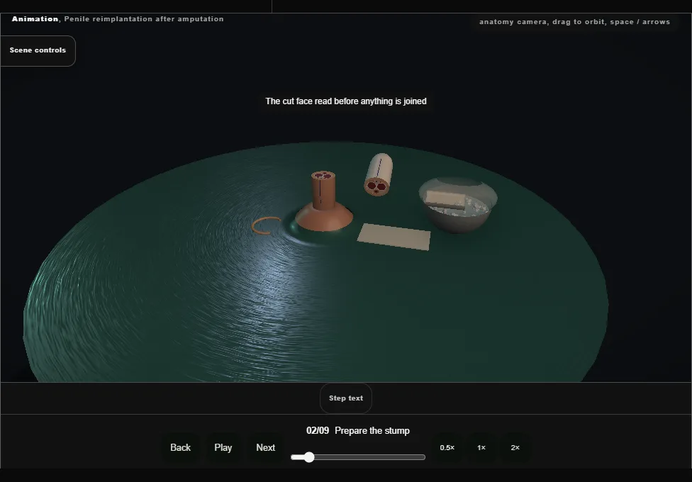 Penile reimplantation after amputation. Step 2: Prepare the stump. Captured frame from the interactive animation.