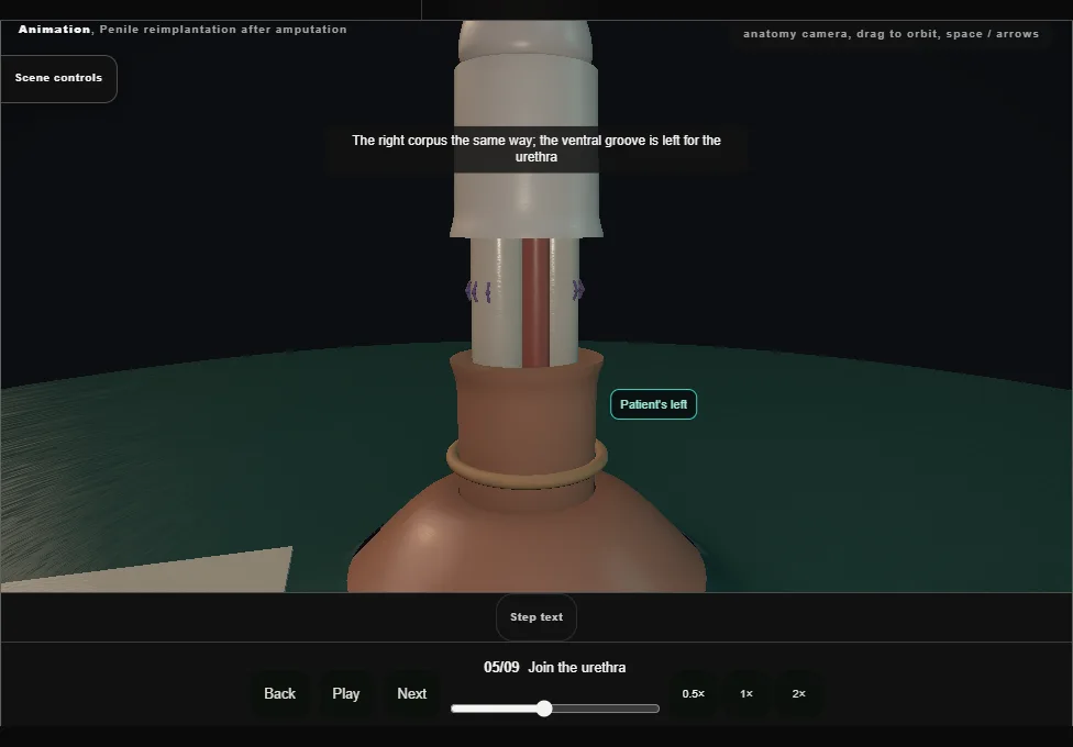 Penile reimplantation after amputation. Step 5: Join the urethra. Captured frame from the interactive animation.