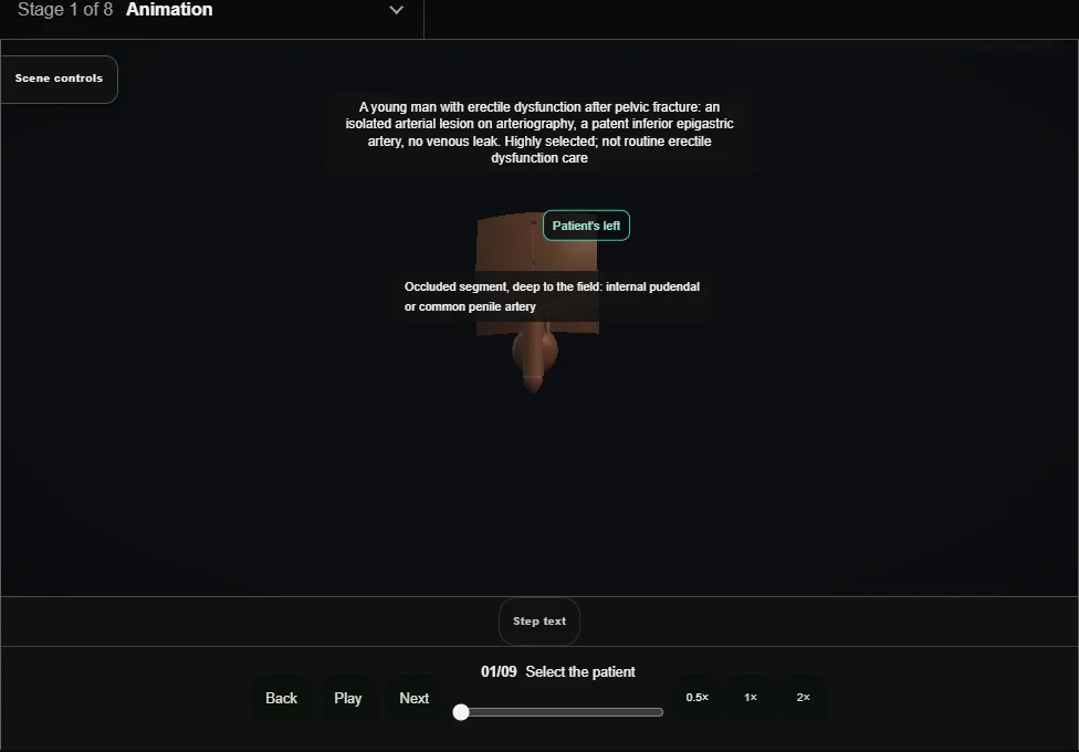 Penile arterial revascularisation: inferior epigastric to dorsal artery. Step 1: Select the patient. Captured frame from the interactive animation.