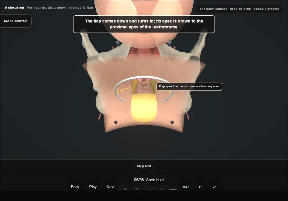 Perineal urethrostomy: inverted-U flap. Step 6: Apex inset. Captured frame from the interactive animation.
