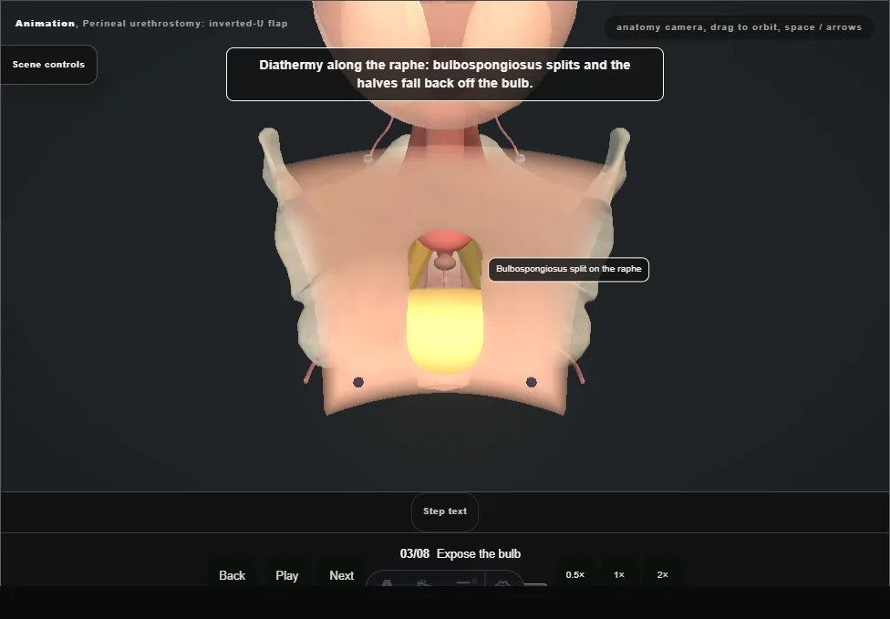 Perineal urethrostomy: inverted-U flap. Step 3: Expose the bulb. Captured frame from the interactive animation.