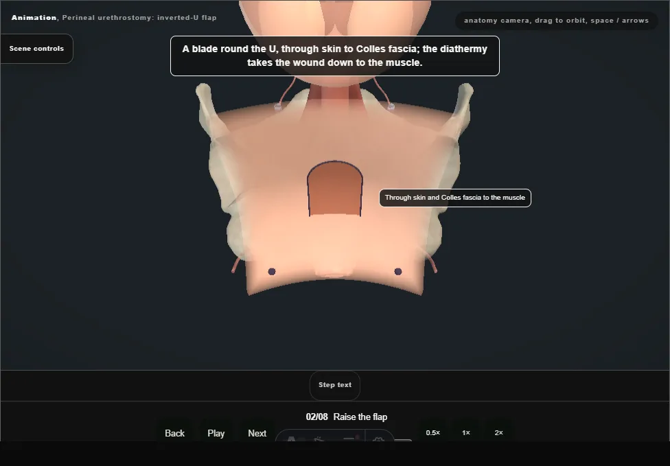 Perineal urethrostomy: inverted-U flap. Step 2: Raise the flap. Captured frame from the interactive animation.