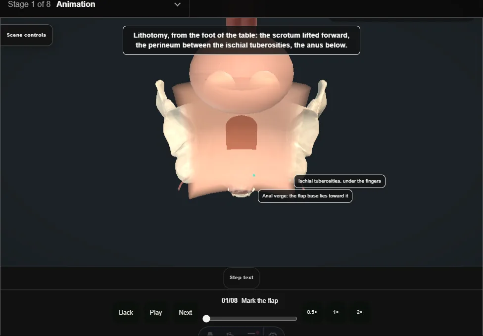 Perineal urethrostomy: inverted-U flap. Step 1: Mark the flap. Captured frame from the interactive animation.