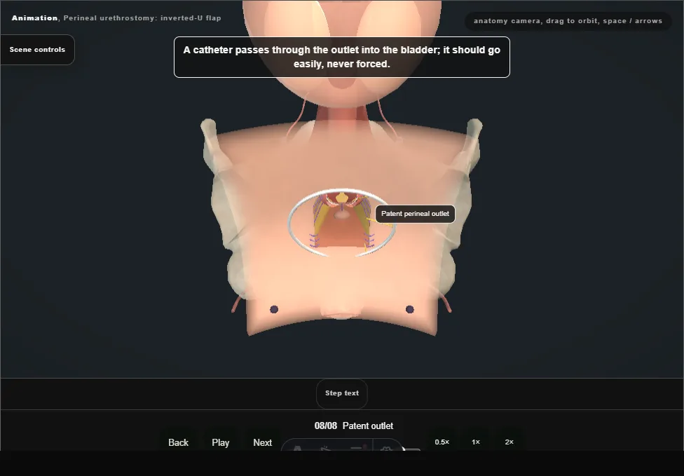 Perineal urethrostomy: inverted-U flap. Step 8: Patent outlet. Captured frame from the interactive animation.