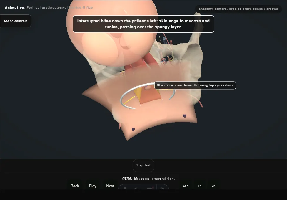 Perineal urethrostomy: inverted-U flap. Step 7: Mucocutaneous stitches. Captured frame from the interactive animation.