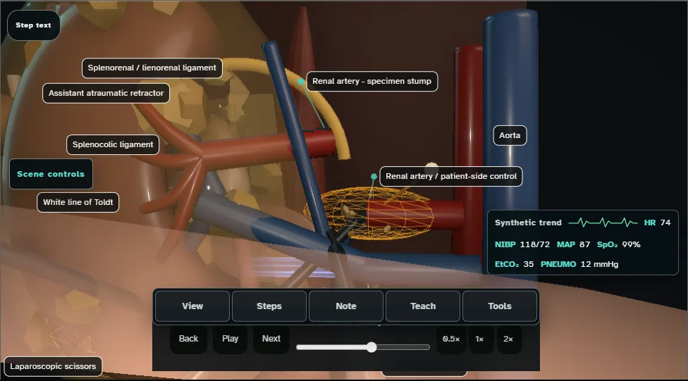 Radical nephrectomy (laparoscopic) - spatial danger atlas. Step 4: Artery first. Captured frame from the interactive animation.